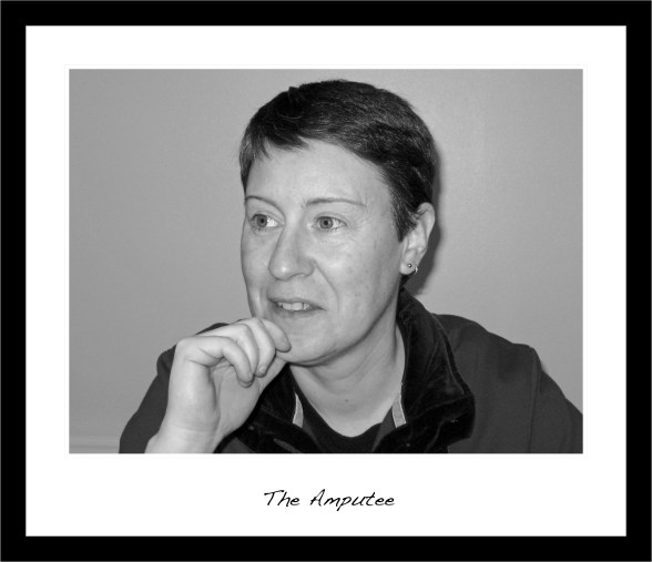 The Amputee
